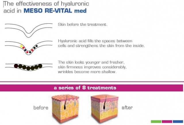 blogger-image--501650544